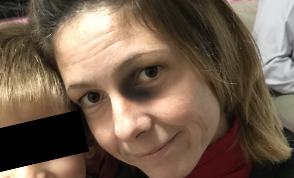 Busnago – Si scaglia contro i ladri per proteggere il figlio