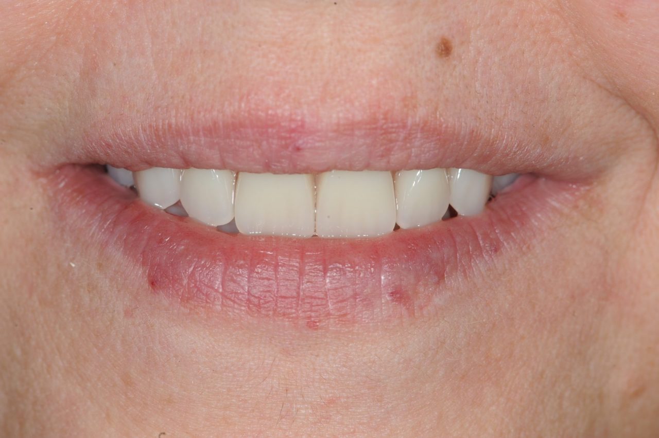 Dentista a Vimercate, studio del dottor Paolo Arosio