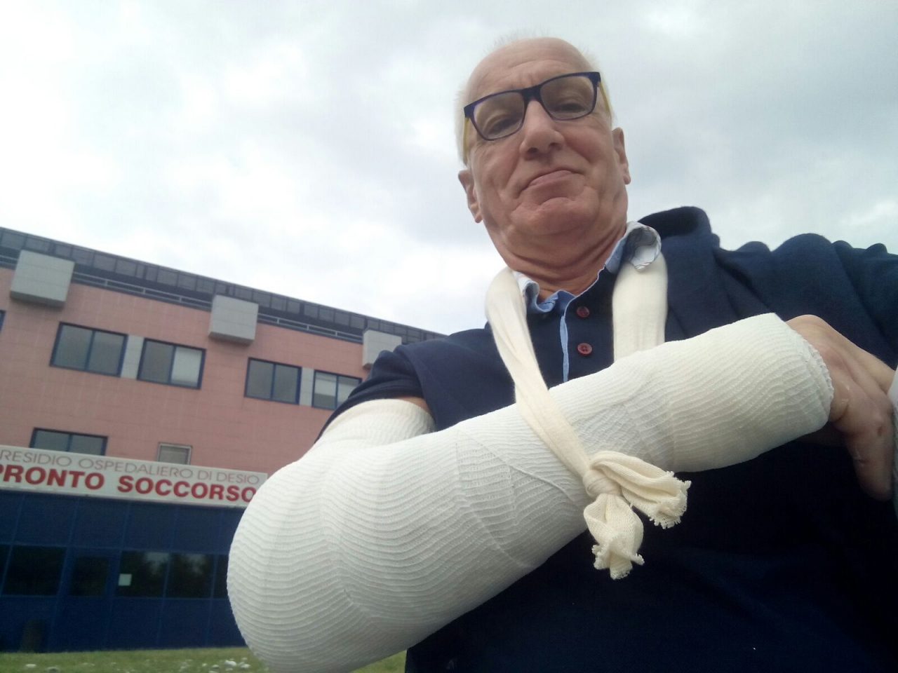 Buca in strada a Varedo, ex consigliere cade e chiede i danni al Comune