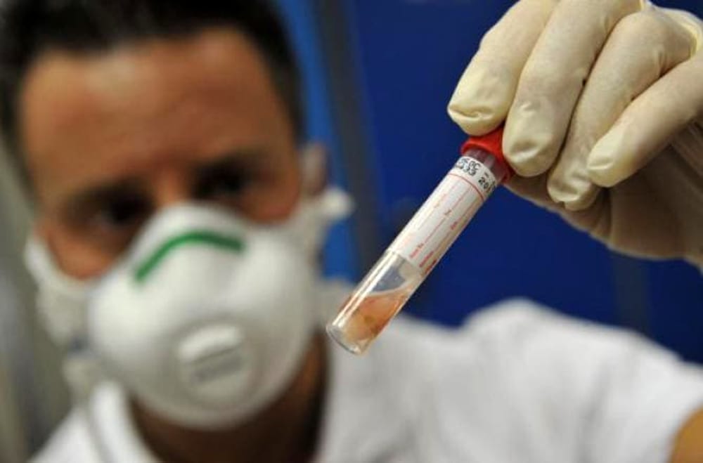 Caso di tubercolosi a scuola in Valtellina