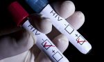 Tornano i test rapidi e le consulenze in occasione della Giornata mondiale contro l’AIDS