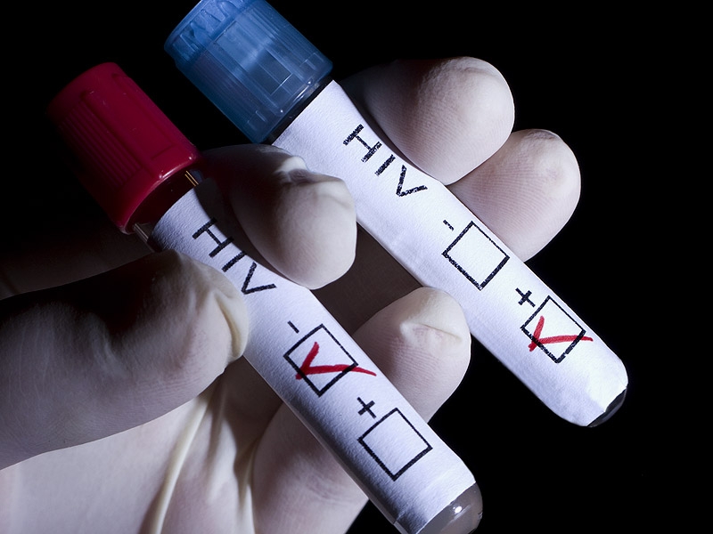 Tornano i test rapidi e le consulenze in occasione della Giornata mondiale contro l’AIDS