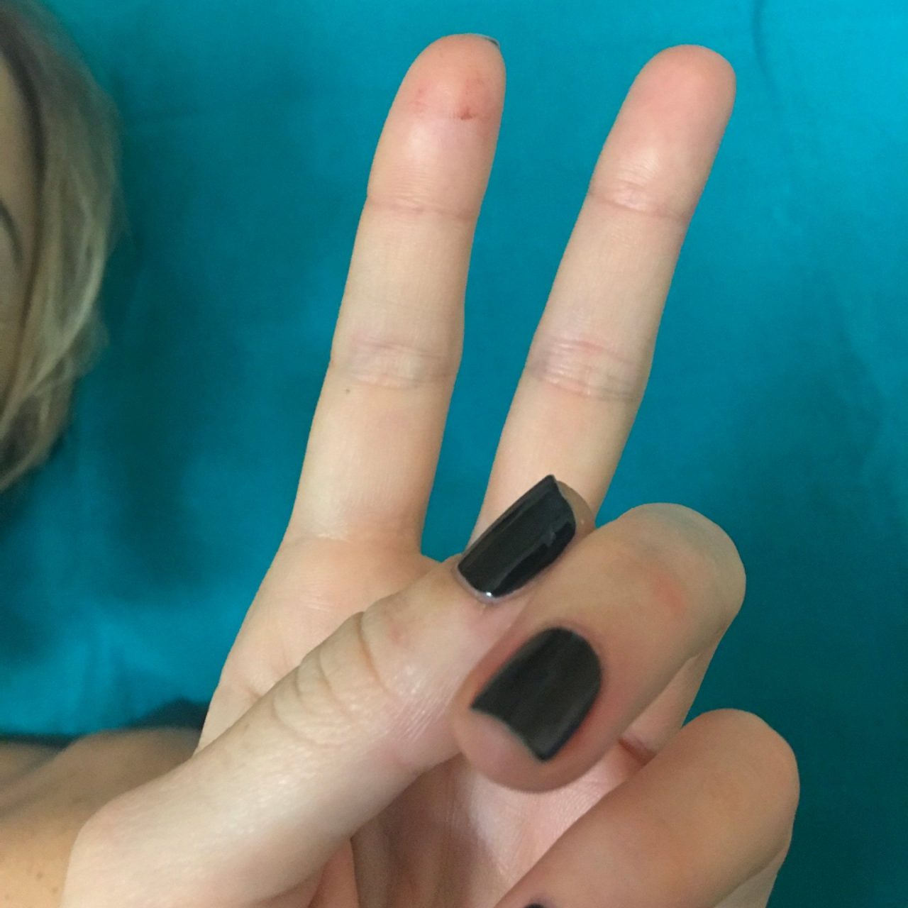 Nadia Toffa sta meglio dopo il malore VIDEO