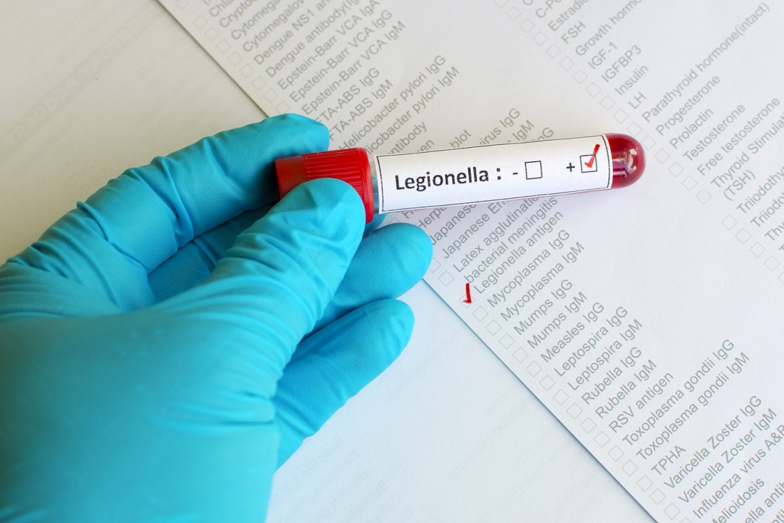 Allarme legionella in un palazzo a Meda dopo la morte di un condomino, il Codacons presenta un esposto