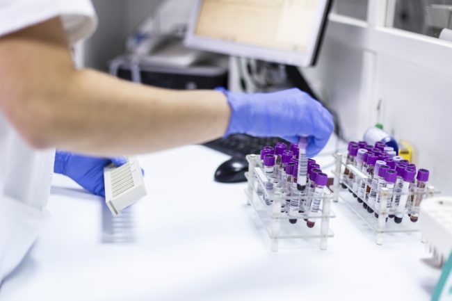 Caso di legionella a Lesmo, arriva la comunicazione di Ats