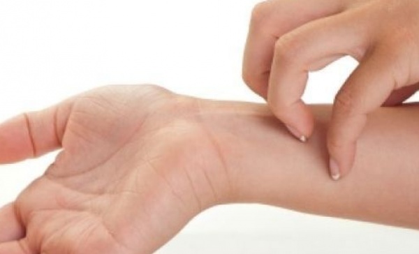 Altro caso di scabbia alle scuole medie