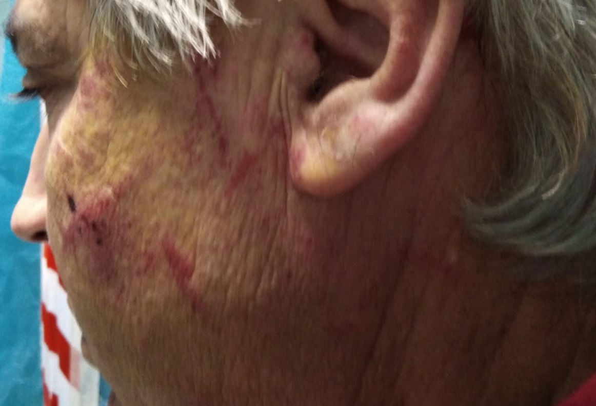 “Hai importunato mia moglie”, poi lo aggredisce e lo mette al tappeto