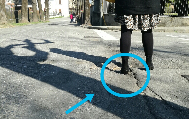 Inciampa in una buca e si rompe il naso