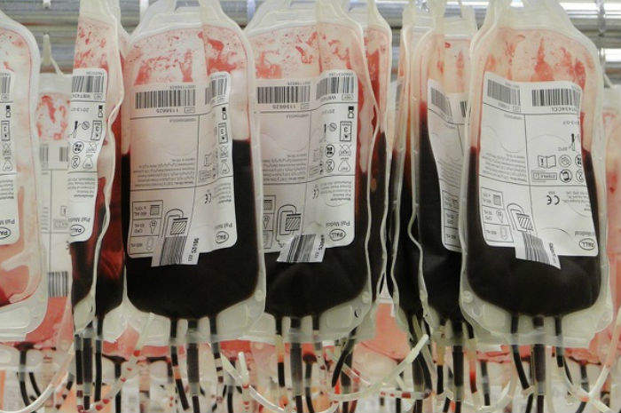 E’ di Arcore la donna morta per la trasfusione di sangue sbagliata