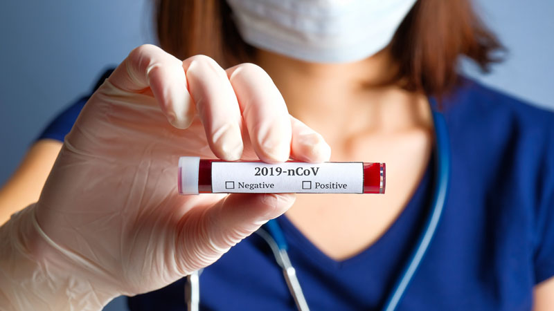 Coronavirus, i contagi aggiornati I DATI COMUNE PER COMUNE
