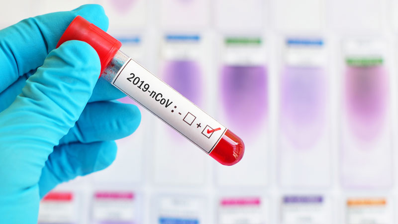 Primo caso di Coronavirus a Seregno