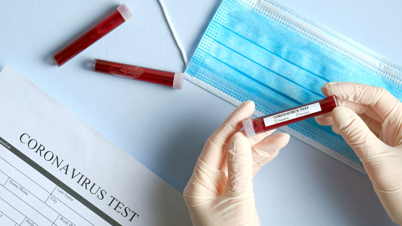 A Solaro primo caso di Coronavirus