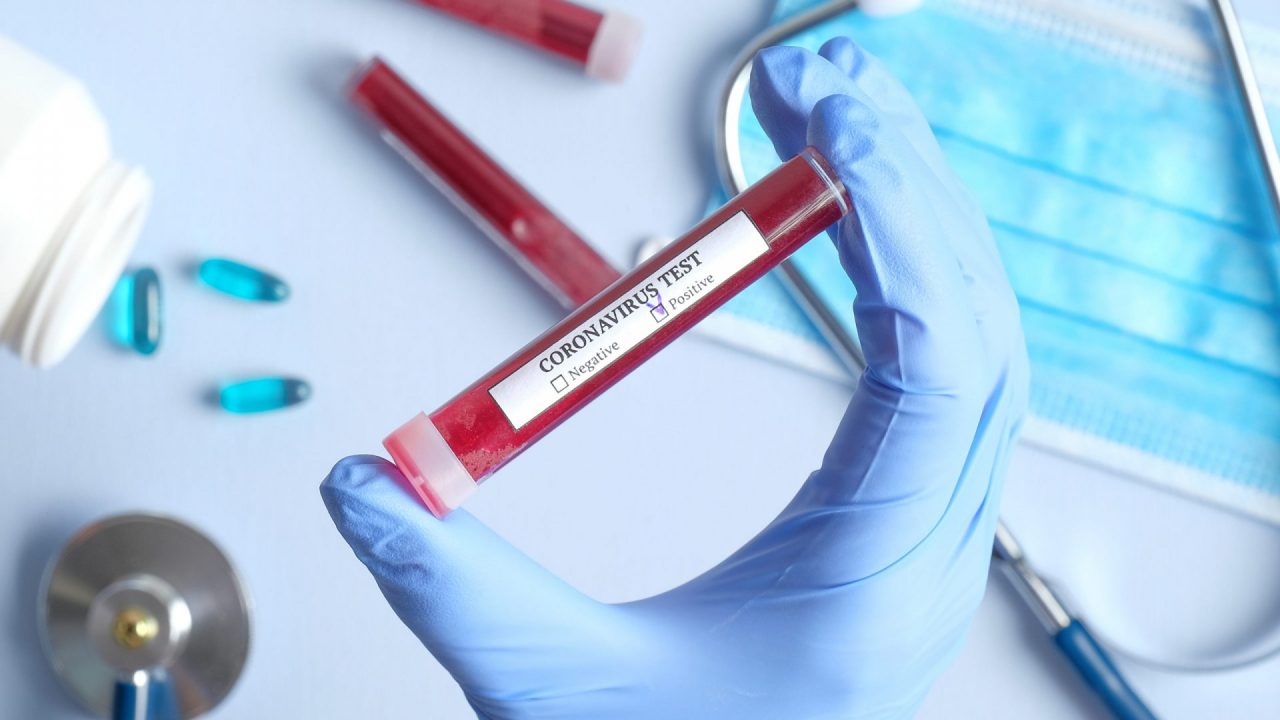 Test sierologici in Brianza, tutte le informazioni