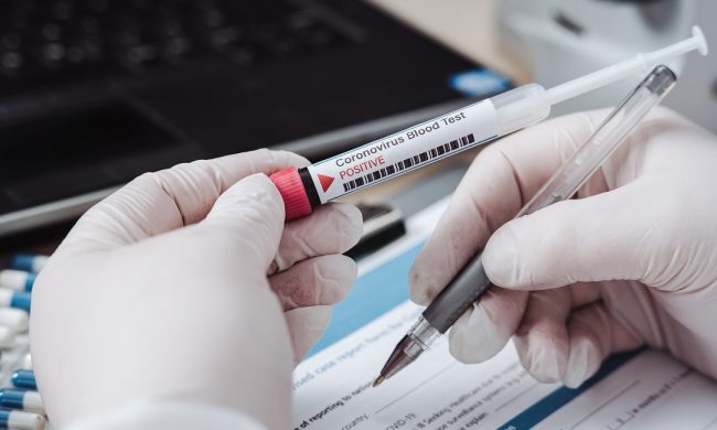 Test sierologici da mercoledì 29 aprile