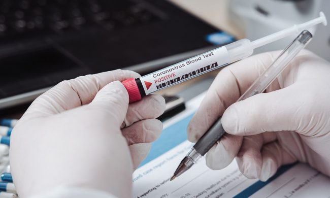 Coronavirus: ecco quali sono i Comuni più colpiti
