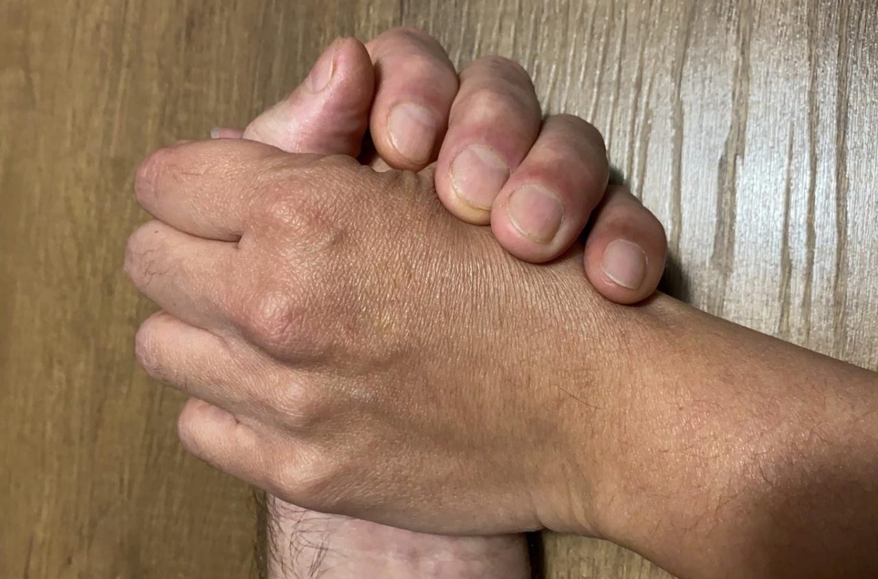 Margherita e Antonio, insieme contro il Covid
