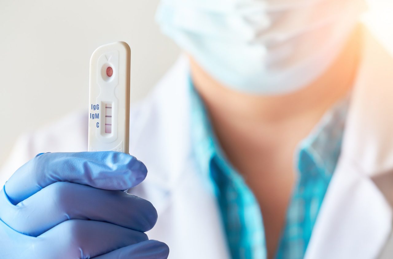 Tamponi rapidi gratuiti per gli studenti dai 14 ai 19 anni