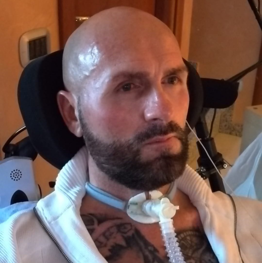 L’ultimo saluto a Tony, guerriero contro la Sla