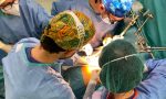 Dieci ore in sala operatoria per un un raro tumore delle vie biliari: intervento riuscito a Vimercate