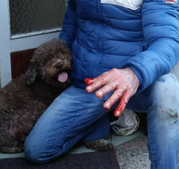 Azzannato da tre pitbull per salvare la sua cagnolina