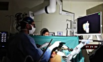 Salvano il fegato durante l'intervento grazie alla ricostruzione in 3D