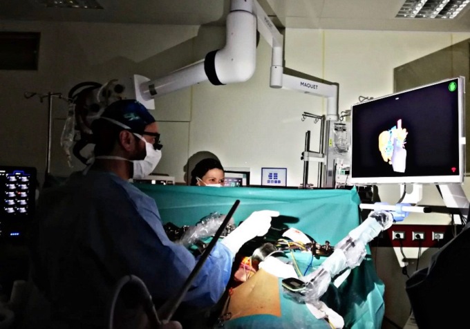 Salvano il fegato durante l’intervento grazie alla ricostruzione in 3D
