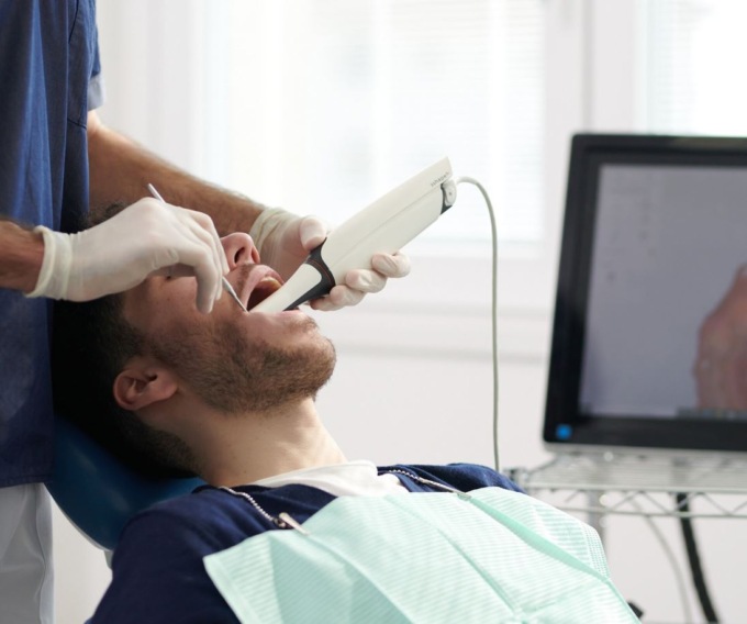 Esempio di una impronta con lo scanner intraorale