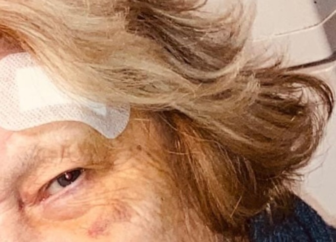 Anziana fugge dall’ospedale in stato confusionale e viene ritrovata ferita per strada 