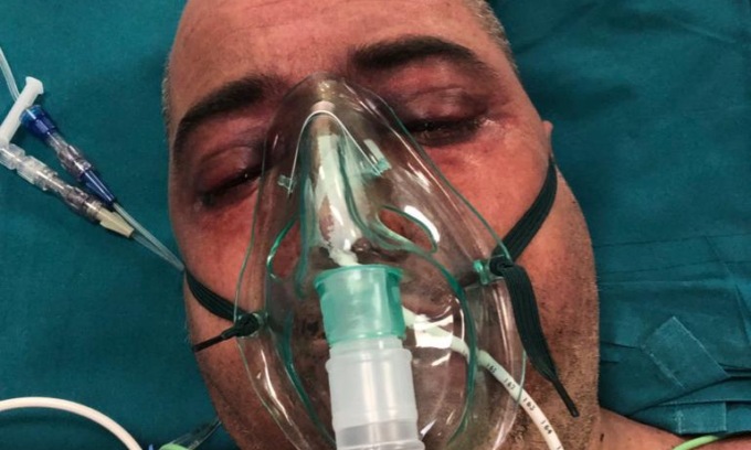 Rischiò la vita dopo un incidente in azienda a Ornago, operaio ora è senza lavoro