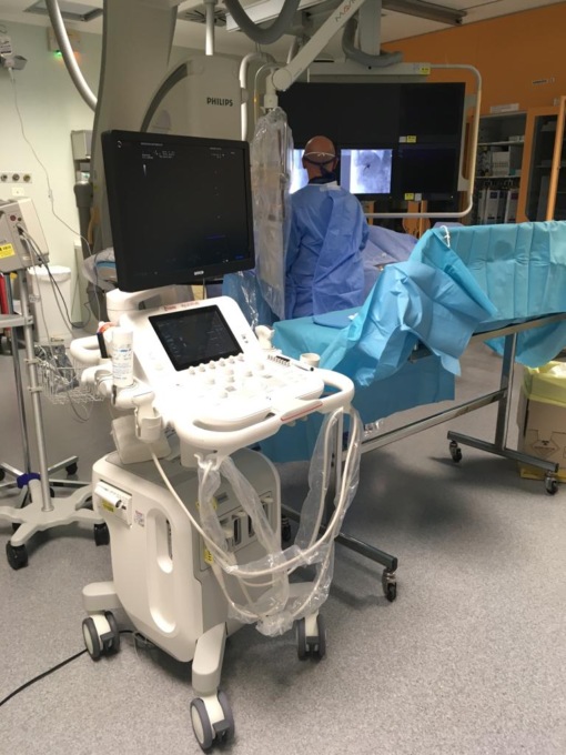 Nuova tecnologia per la Radiologia Interventistica dell’ospedale di Vimercate