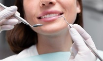 Igiene dentale professionale: perché è importante e ogni quanto farla