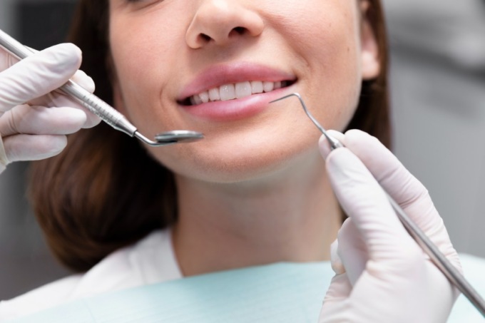 Igiene dentale professionale: perché è importante e ogni quanto farla