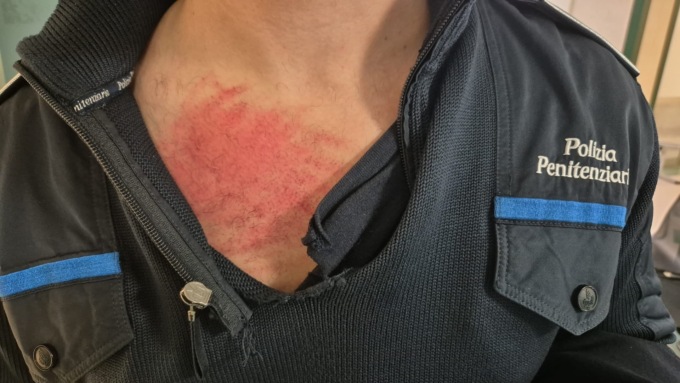 Agente picchiato e mandato in ospedale da uno straniero