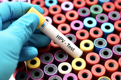 Oggi è la Giornata Mondiale contro l’HPV, in Brianza open day, screening e vaccinazioni