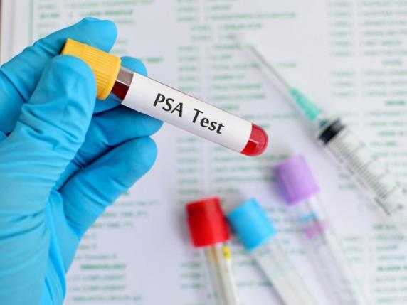 A Carate Brianza giornata di screening gratuiti per Psa e densità ossea