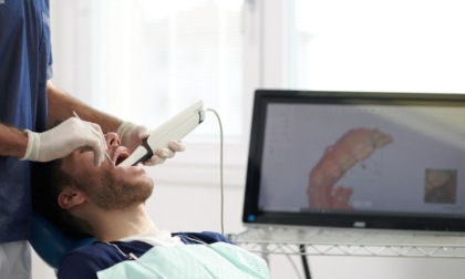 Impronta Digitale: basta con i vecchi materiali  da impronta: comodità e precisione degli scanner intraorali