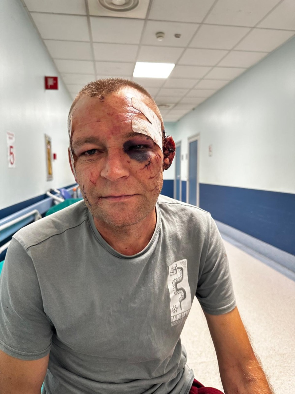 Aggredito a bottigliate nel Parco della pace