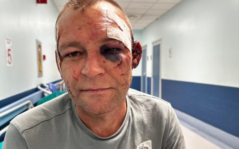 Aggredito a bottigliate nel Parco della pace