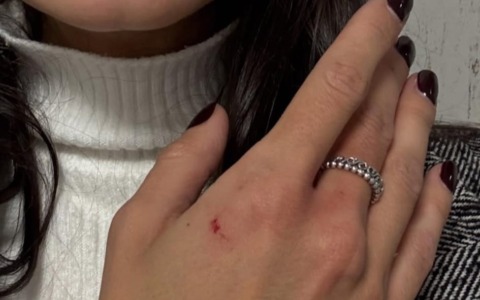 Aggredita e picchiata sul treno: “Ho pensato di morire”