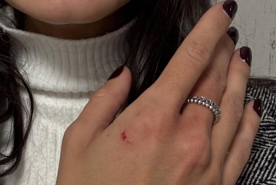 Aggredita e picchiata sul treno: “Ho pensato di morire”