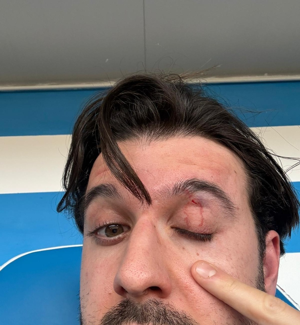 Follia sugli spalti: il direttore tecnico della Folgore Caratese preso a pugni dal papà di un calciatore del Pavia