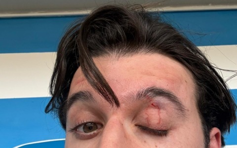 Follia sugli spalti: il direttore tecnico della Folgore Caratese preso a pugni dal papà di un calciatore del Pavia