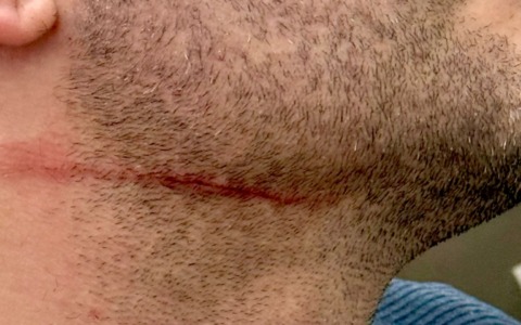 Tassista aggredito con un coltello: «Ha cercato di sgozzarmi»