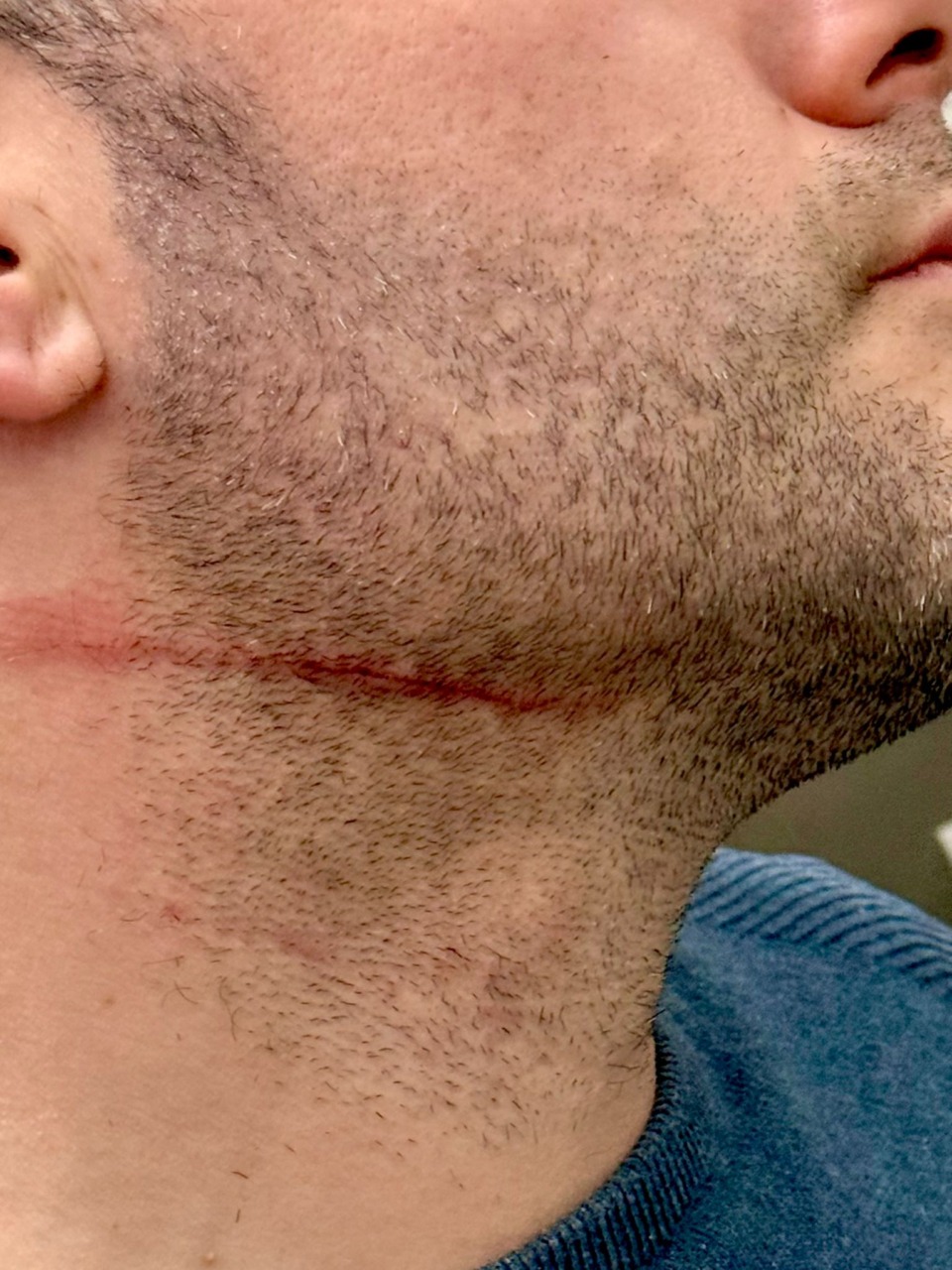 Tassista aggredito con un coltello: «Ha cercato di sgozzarmi»